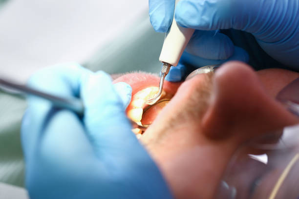 Best Weekend Emergency Dentist in Middletown, CA
