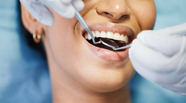 Best Emergency Root Canal Treatment in Middletown, CA