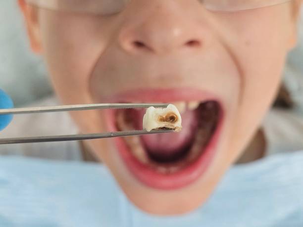 Best Emergency Gum Treatment in Middletown, CA