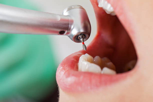Best Cosmetic Emergency Dentistry in Middletown, CA